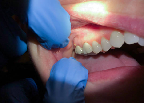 Best Emergency Gum Pain Relief  in Ashdown, AR